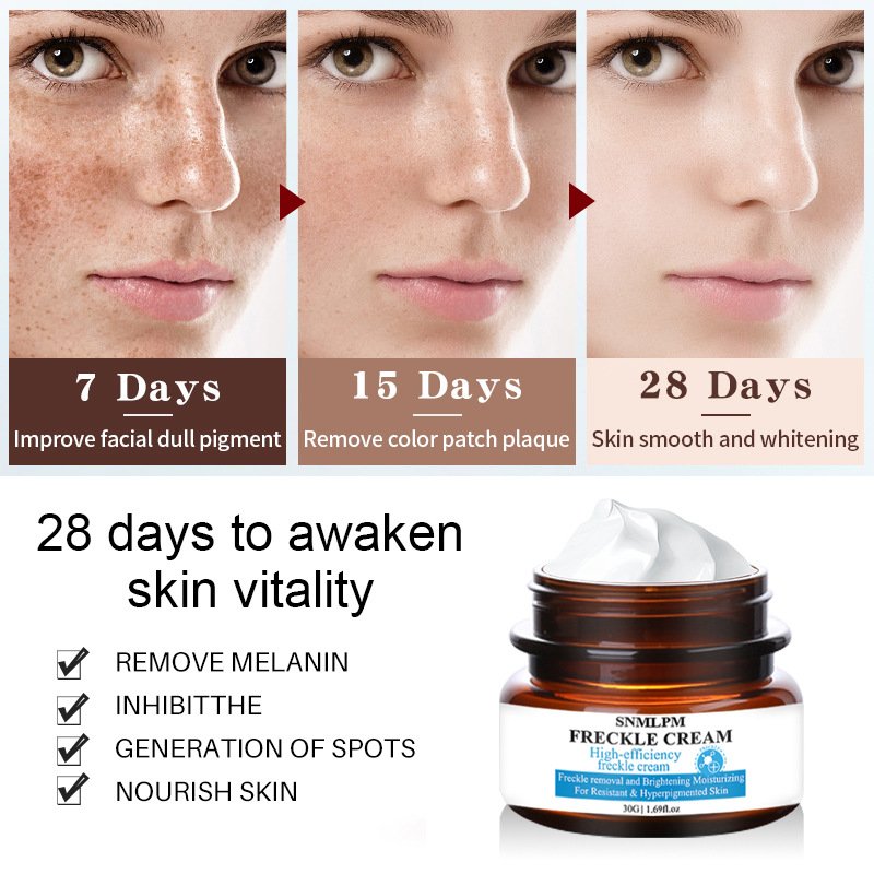 Private label Freckle cream Moisturizing Reducing melanin Whitening Brightening Face Cream for all skin types Skin Care product