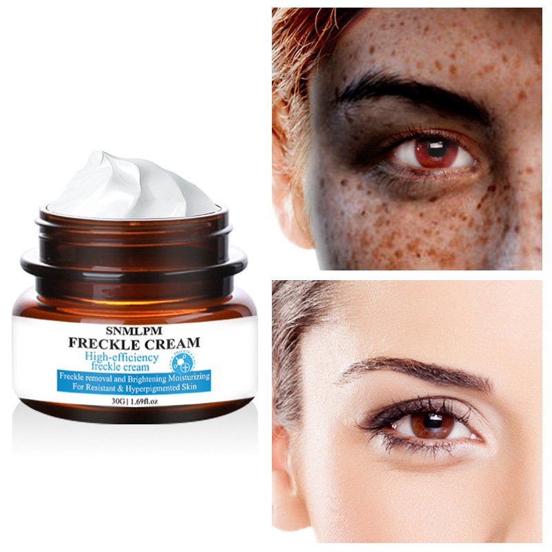 Private label Freckle cream Moisturizing Reducing melanin Whitening Brightening Face Cream for all skin types Skin Care product
