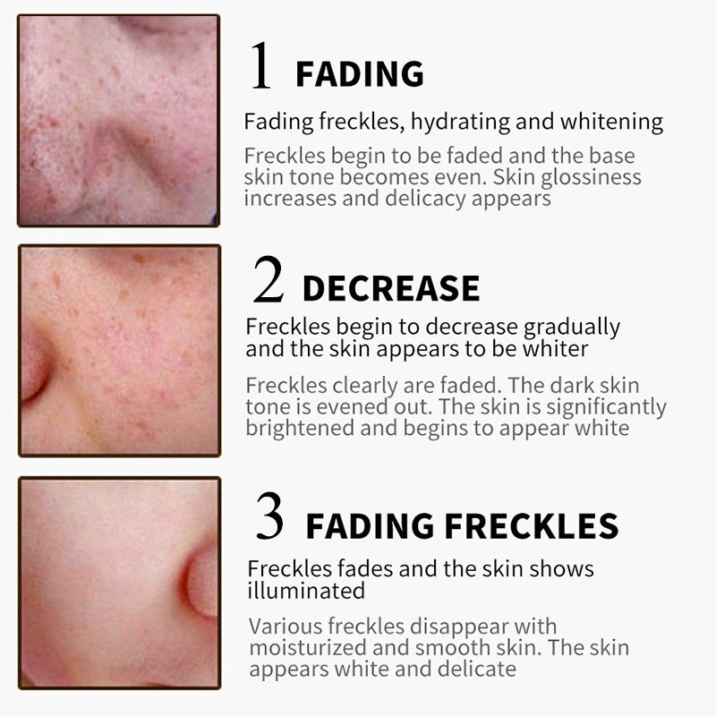 Private label Freckle cream Moisturizing Reducing melanin Whitening Brightening Face Cream for all skin types Skin Care product