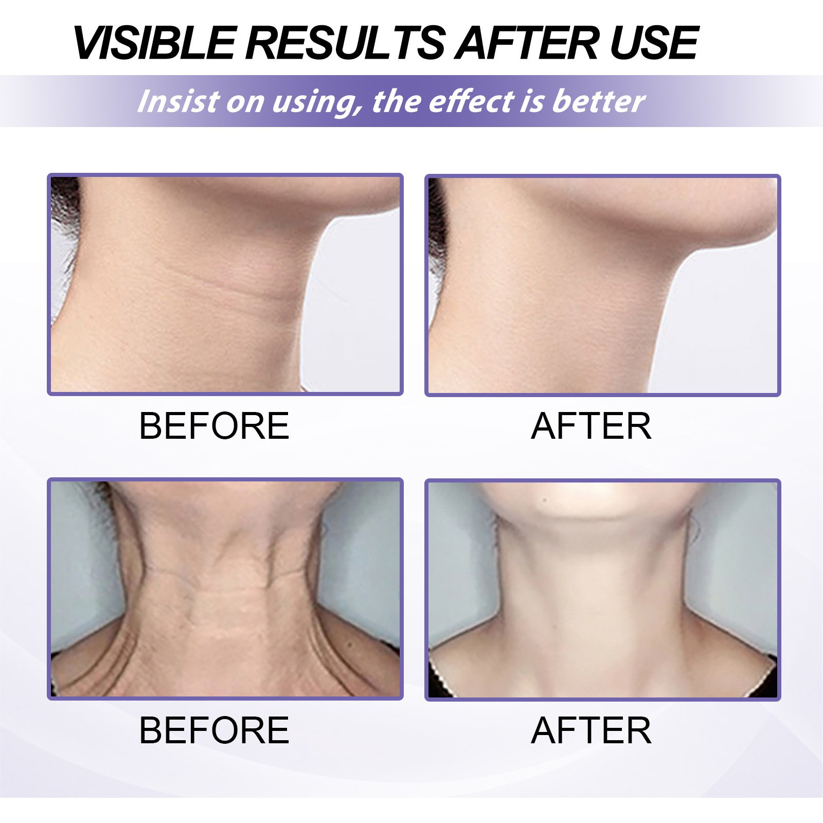 Skin Care Moisturizer Firming Wrinkle Remover Face Cream Organic Anti Aging Face Neck Retinol Cream