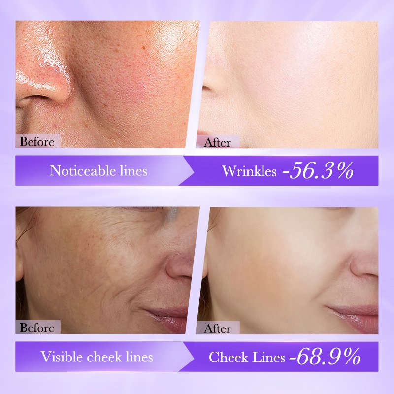 BIOAQUA Retinol Anti Wrinkle Firming Face Cream Private Label Cosmetic Beauty Skin Care Product Moisturizer Brightening Cream