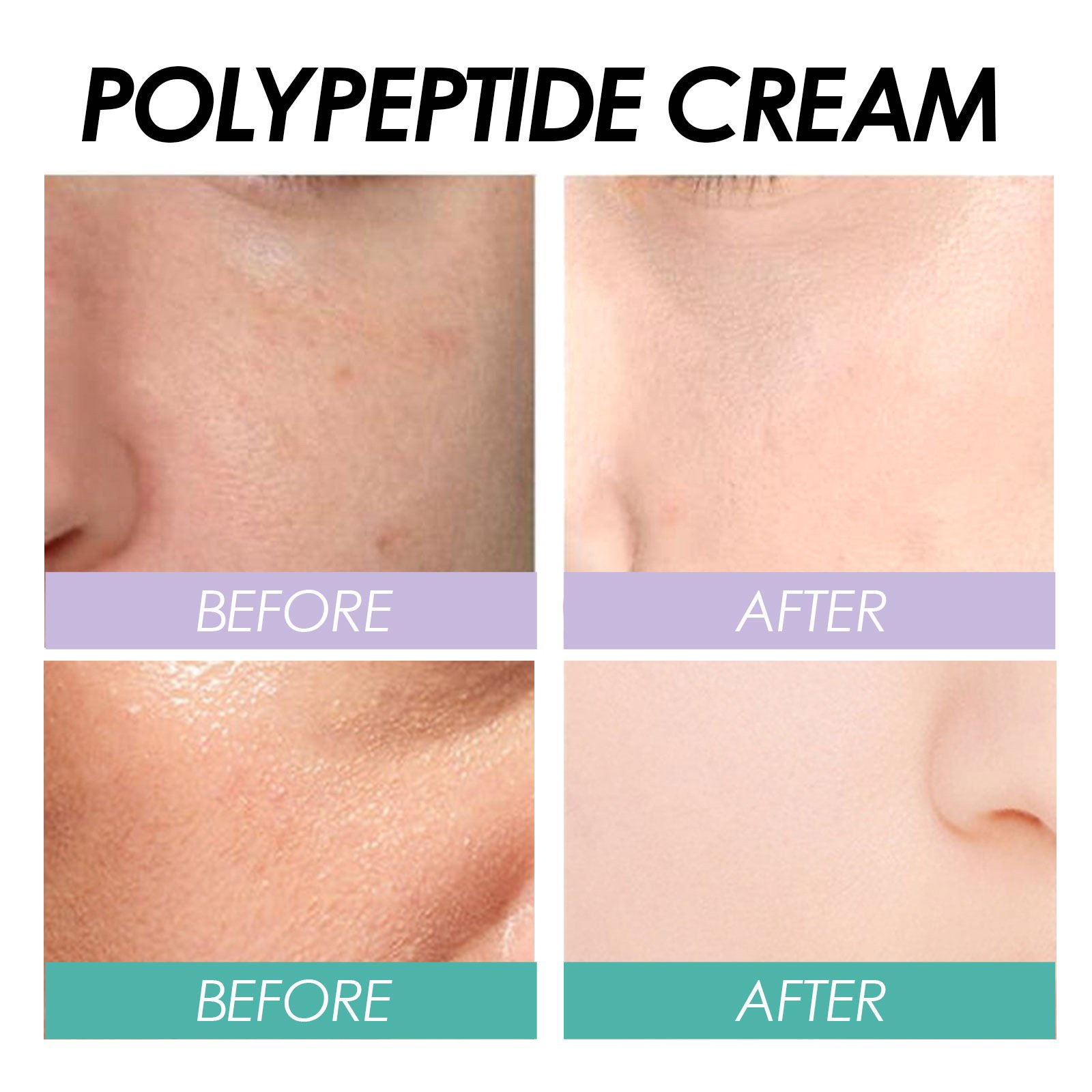 Private Label Organic Moisturizing Polypeptide Cream Wrinkle Removal Smooth Skin Anti Aging Face Cream For Dry And Rough Skin