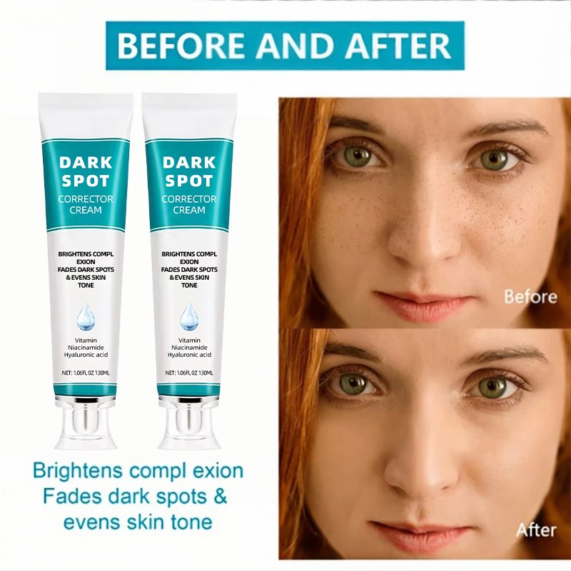 Custom logo skin care remove black spots cream reduce pigmentation smooth skin Repair Skin face cream
