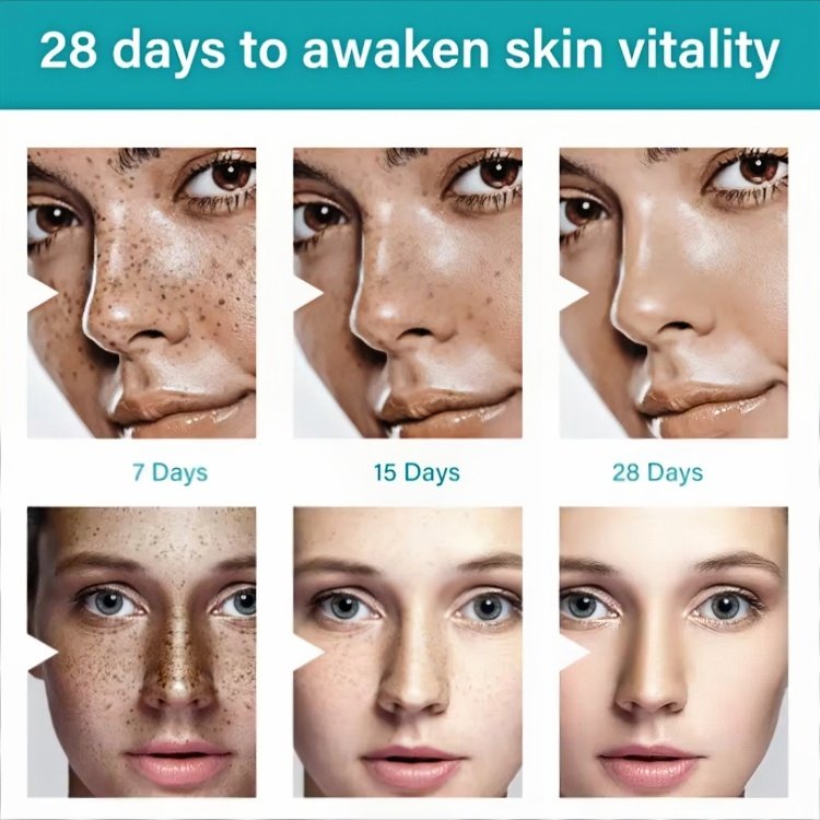 Custom logo skin care remove black spots cream reduce pigmentation smooth skin Repair Skin face cream