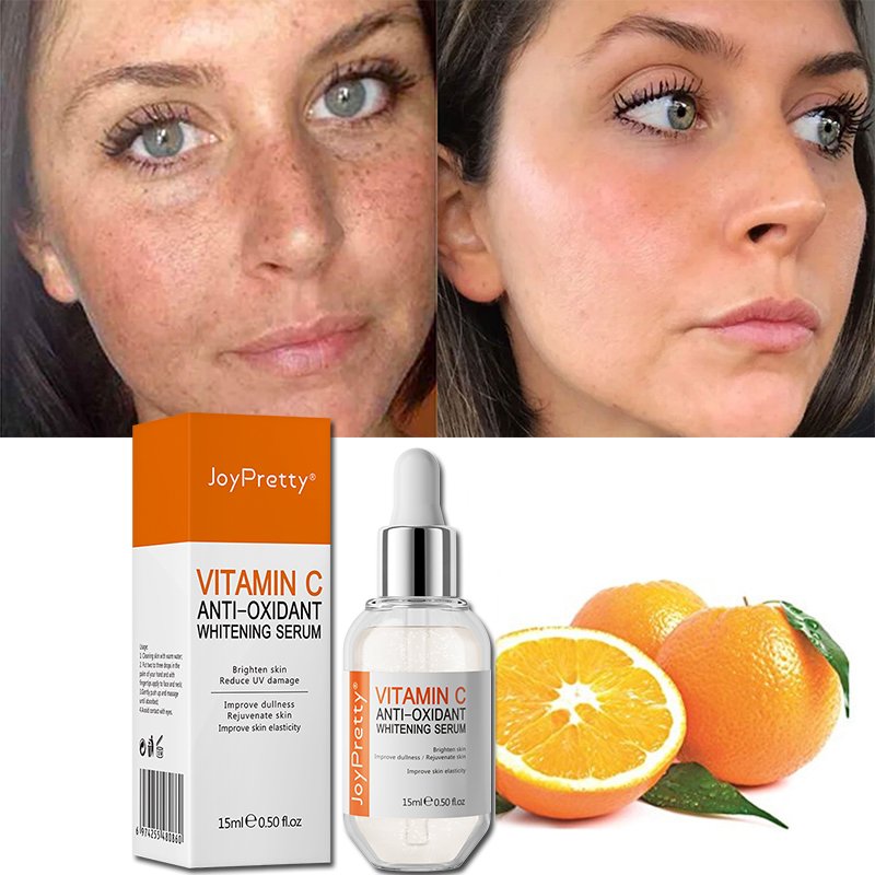 Wholesale Korean Cosmetics Skin Care Beauty Whitening Vitamin C Set Lightening Face Cream For Dark Spot Removal