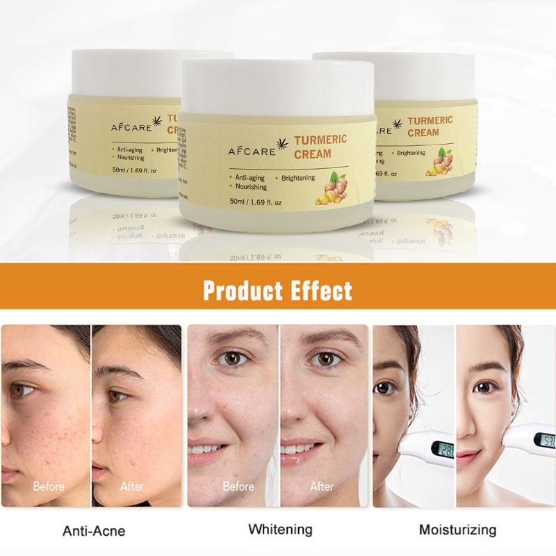 Whitening Cream for Face Paraben-Free Moisturizer Anti-Acne & Nicotinamide Kojic Acid and Turmeric Face Cream