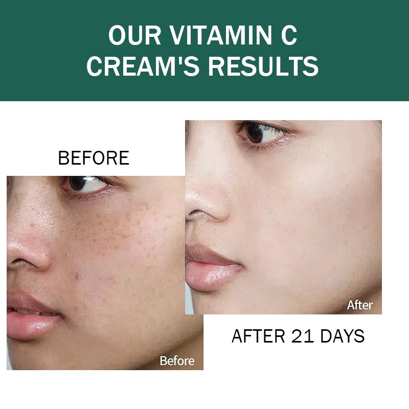 Acne treatment cream Face Products Skin Care Natural Collagen Peptides Moisturizing Whitening Anti-Aging Face Cream