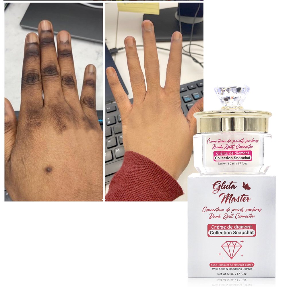 OEM Natural Organic Anti-Age Anti-Wrinkle Face Whitening Cream Moisturizer Whitening Face Cream for Dark Spots Removing