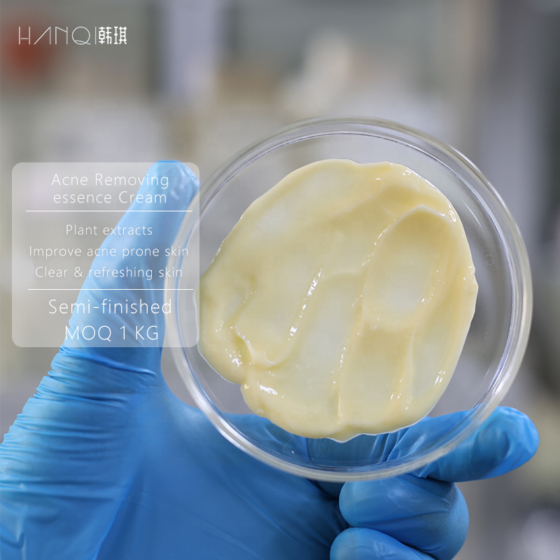 Acne removing essence cream compound plant essence formula anti & reduce ance 1kg semi-finished face cream