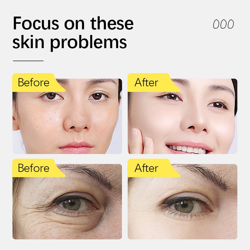 Private Label Skin Care Anti-wrinkle Anti Aging Face Cream Pro-Xylane Firming Moisturizing Face Cream For The Face