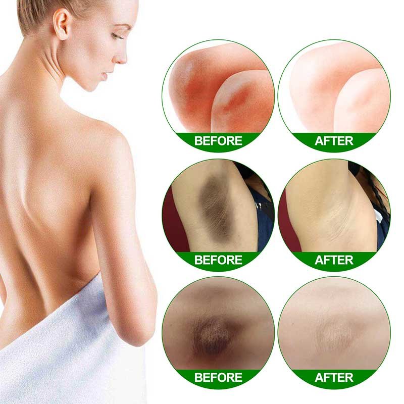 OEM Body Whitening Cream Bleaching Serum Remove Melanin Pigmentation Brighten Inner Thigh Skin Moisturizing Cream