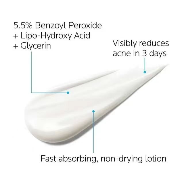 whitening and moisturizing Acne removing and repairing serum Soothing face cream Anti acne lotion 40ml