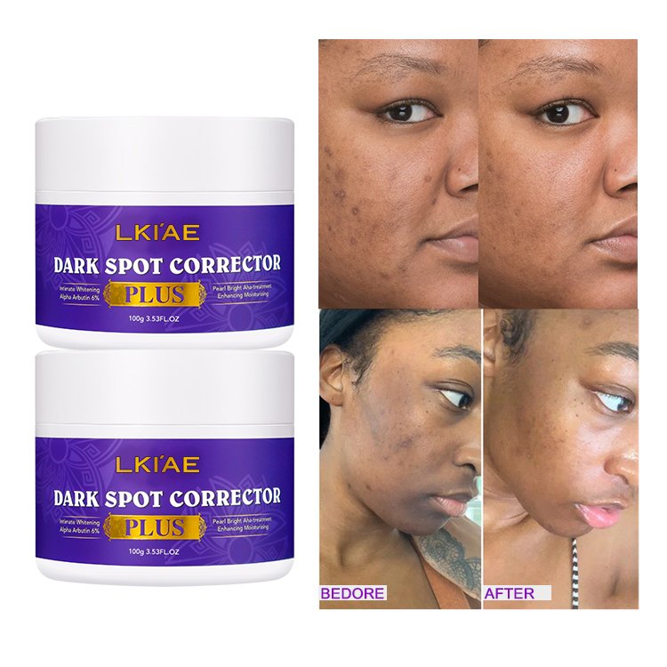 Organic Corrector Cream Brightening Skin Care Set 7 Days Strong Whitening Moisturizer Pimples Dark Black Spot Remover Face Cream