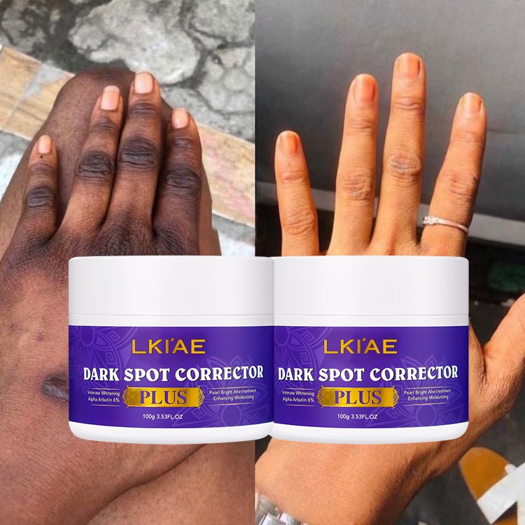Organic Corrector Cream Brightening Skin Care Set 7 Days Strong Whitening Moisturizer Pimples Dark Black Spot Remover Face Cream