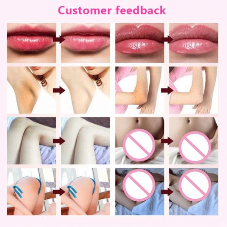 Natural Dark Spot Treatment Face Cream Tea Tree Whitening Moisturizer Facial Cream