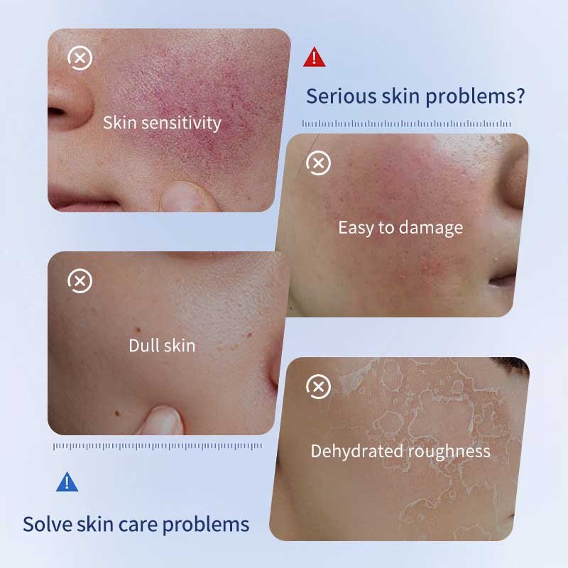 Beauty Cosmetics Private Label Vegan Vitamin B5 Whitening Facial Cream Lotion Kojic Acid Face Cream for Fair Skin