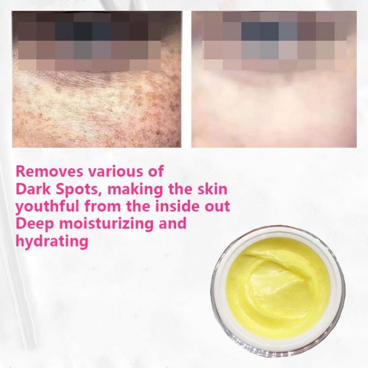 Top Quality Whitening And Freckle Removal Cream Dilute The Stain, Senile Spot, Chloasma, Whitening Cream
