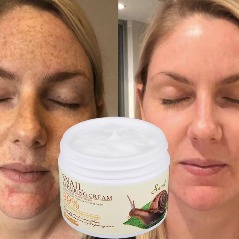 oem vitamin c anti aging wrinkle dark spot remover,private label kojic acid freckle remover,whitening face cream