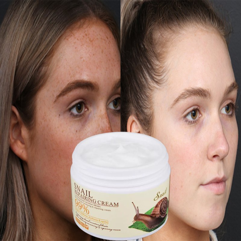 oem vitamin c anti aging wrinkle dark spot remover,private label kojic acid freckle remover,whitening face cream