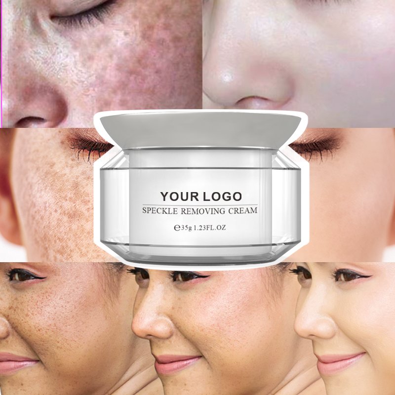 Pimples Dark Spot Remover Cream Products For Melasma Whaitning Face Cream