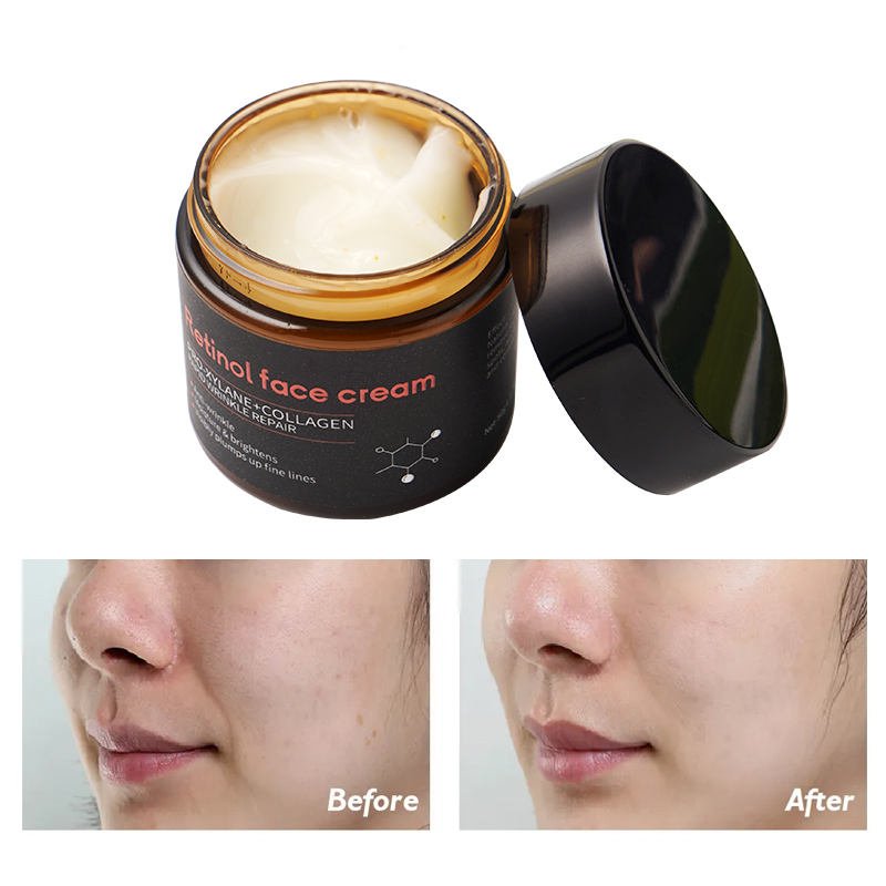 Retinol moisturizer hyaluronic acid instant wrinkle remover face cream firming lifting anti aging face cream