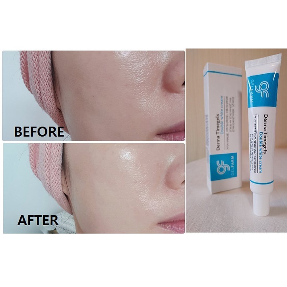 Good Product in Korea Face Cream GELFARM DERMA TIMEGELS DOUBLE WHITE CREAM highly Moisturizing Whitening Effect