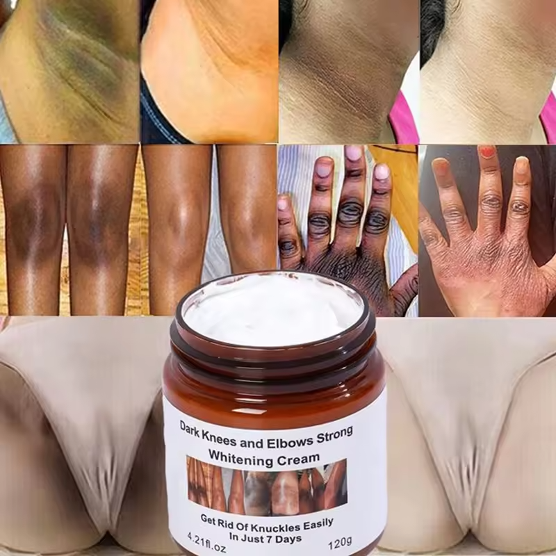 Private Label Dark Knees Elbows Strong Black Removal Cream 7 Days Dark Spot Corrector Skin Care Whitening Body Face Cream