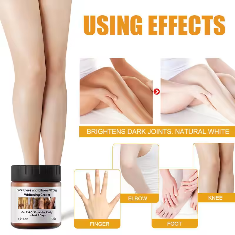 Private Label Dark Knees Elbows Strong Black Removal Cream 7 Days Dark Spot Corrector Skin Care Whitening Body Face Cream
