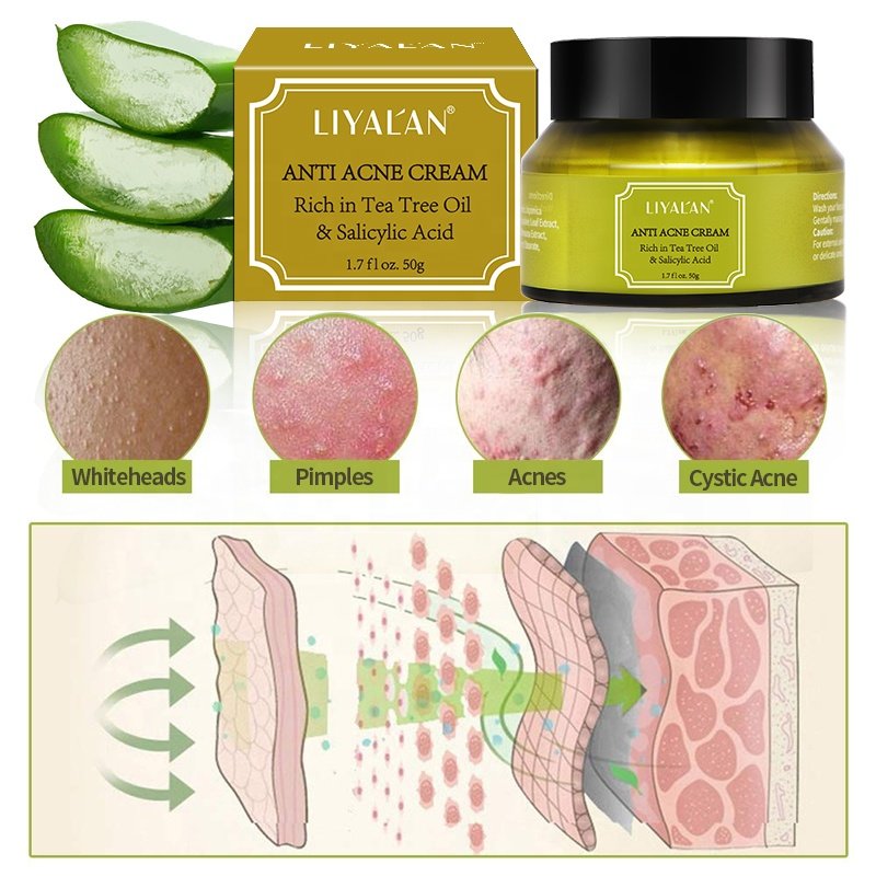 Private Label Tea Tree Oil Salicylic Acid Skin Repair Lighten Anti Acne Scar Pimple Shrink Pores Face Cream