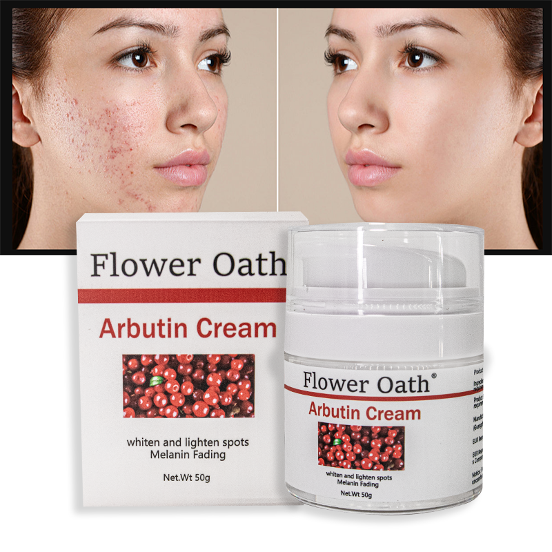 OEM Private Label Nicotinamide arbutin whitening and beautifying essence cream moisturizing and lightening stain face cream