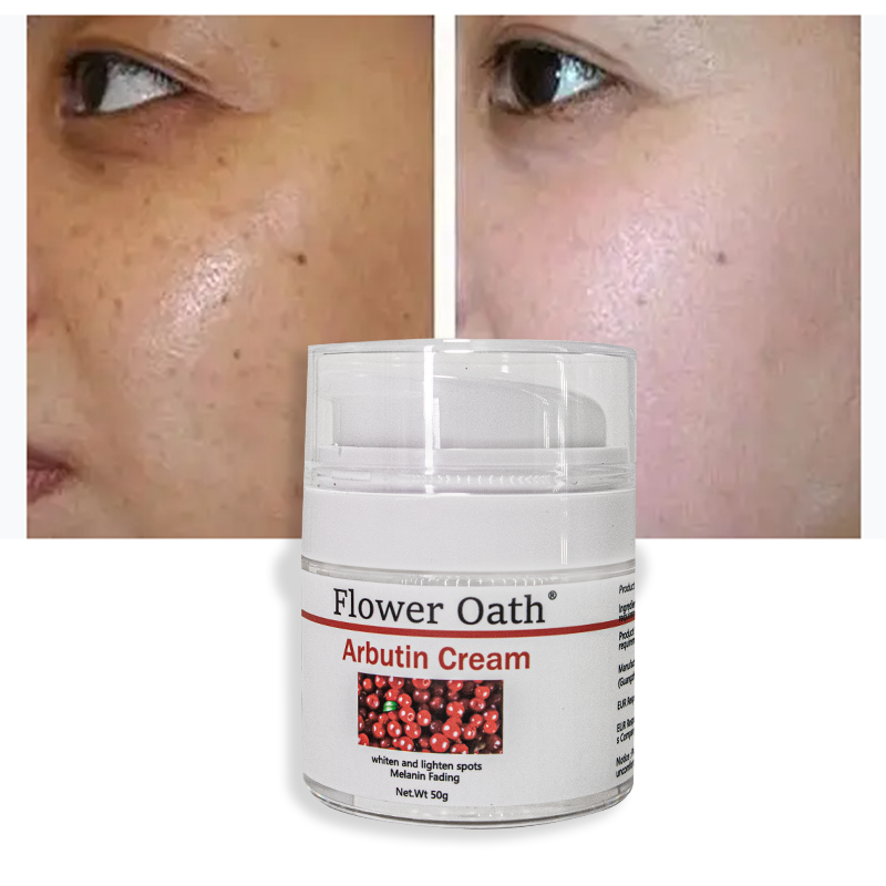 OEM Private Label Nicotinamide arbutin whitening and beautifying essence cream moisturizing and lightening stain face cream