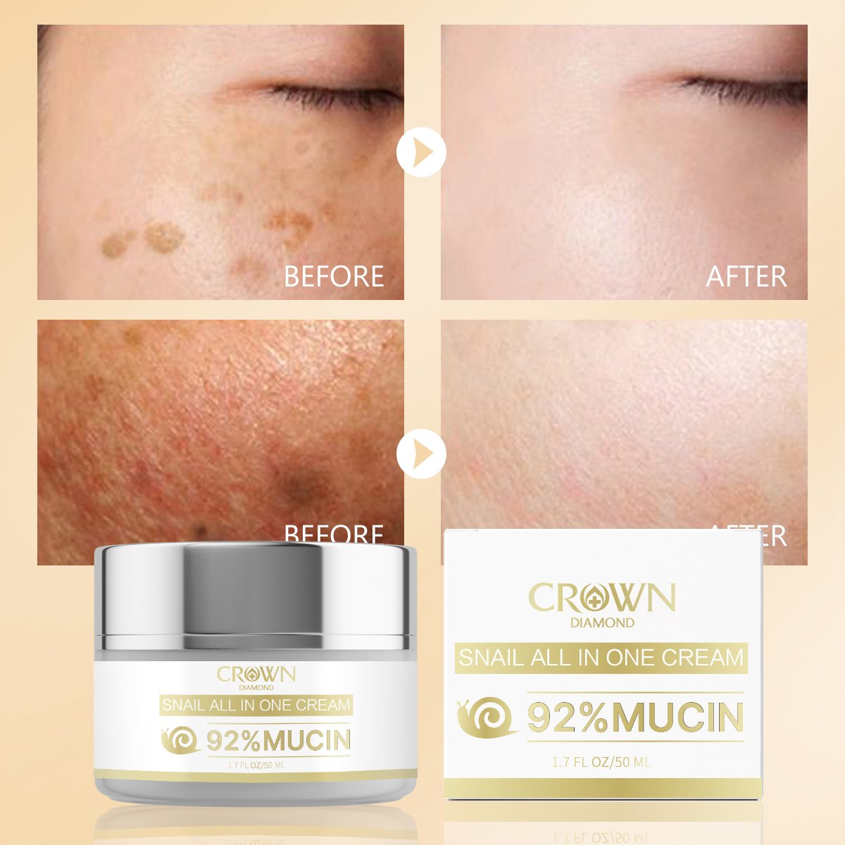 Private Label Organic Hyaluronic Acid Facial Moisturizing Repair Whitening Tightening Anti Aging Wrinkle Snail Mucin Face Cream