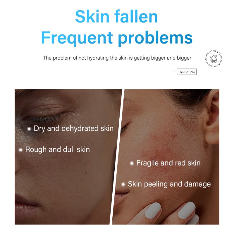 Sodium Hyaluronate Hydrating Cream Restoring Skin Elasticity Face Cream