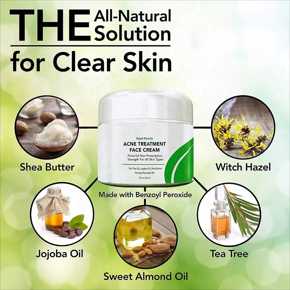 Private label OEM skin care beauty benzoyl peroxide acne treatment cream anti acne pimple tea tree oil Face Cream