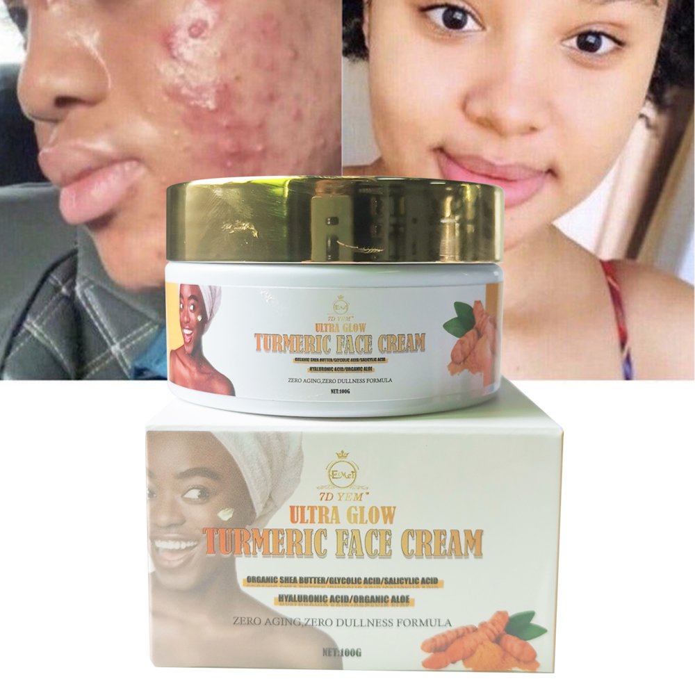 Turmeric skincare face cream acne dark spot remove whitening face natural organic women exfolition whitening skin cream