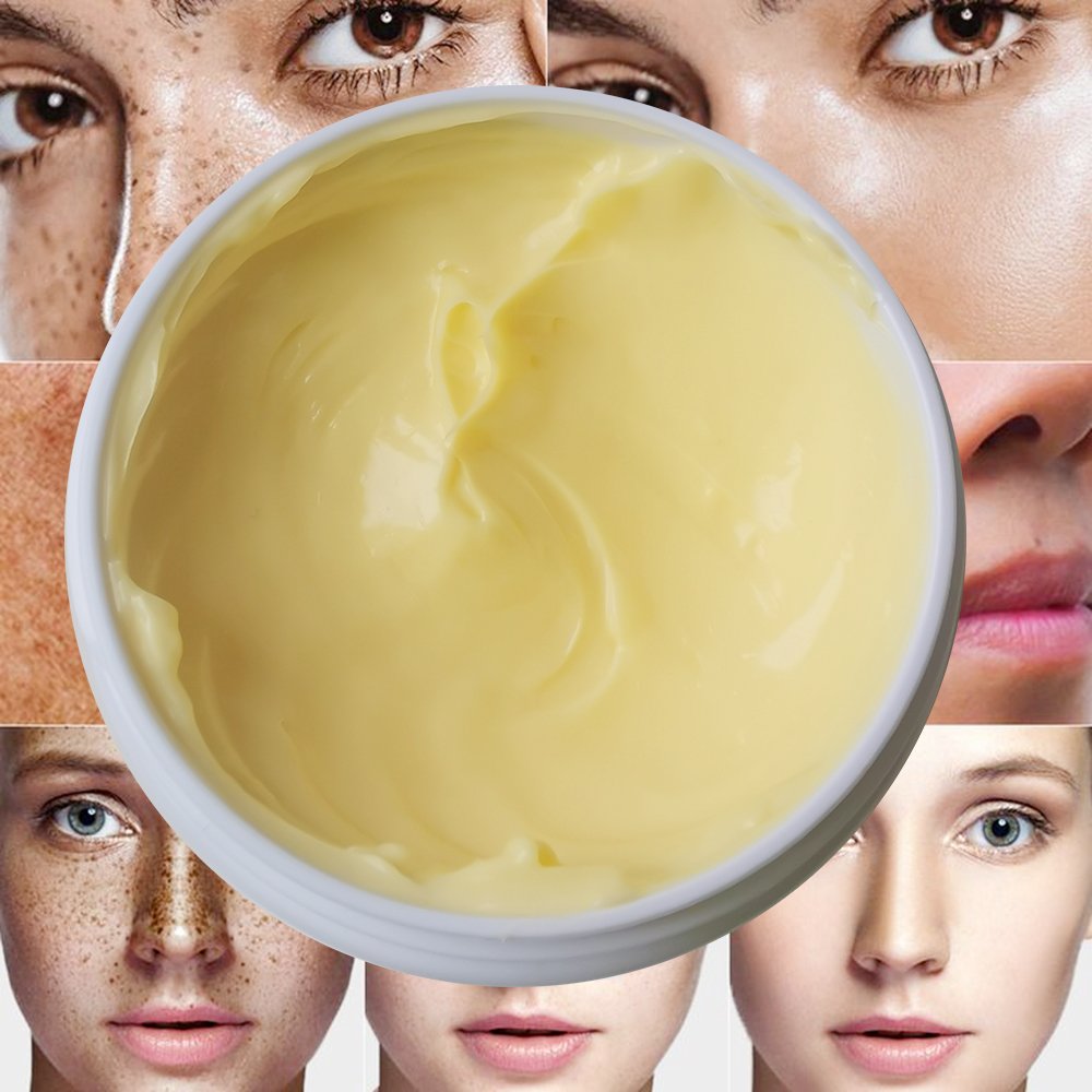 Turmeric skincare face cream acne dark spot remove whitening face natural organic women exfolition whitening skin cream