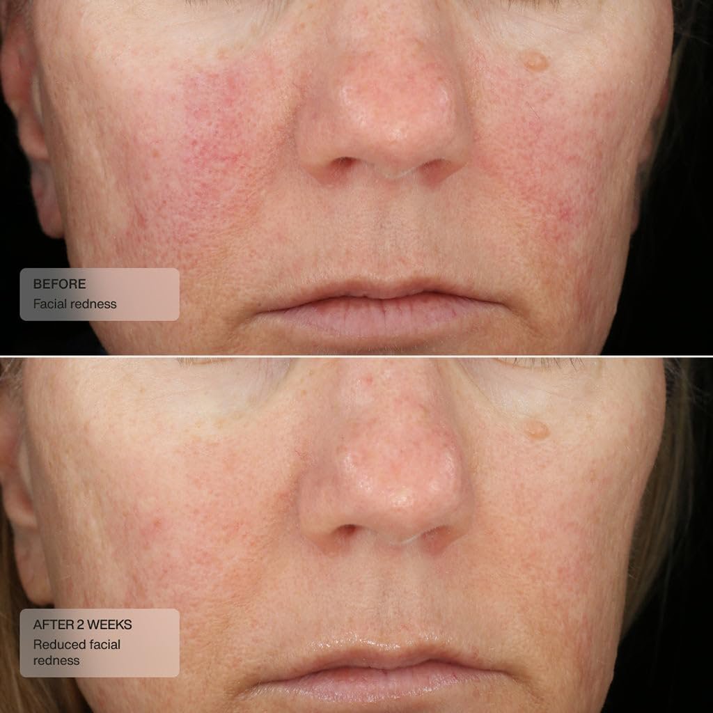 Factory price OEM Anti-aging deep Moisturizing nourishing moisturizer Collagen hydrating face cream
