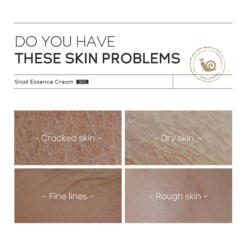 Portable Anti-Aging Anti Aging Retinol Face Cream To Remove Dark Spots