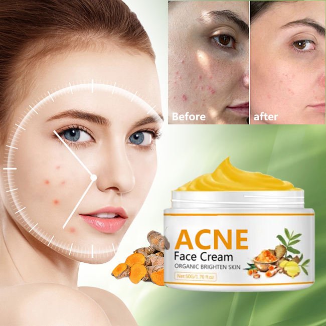 Private Label Skin Care Hyaluronic Acid anti Acne Cream Whitening Facial Creams Brightening Turmeric Face Cream For Women