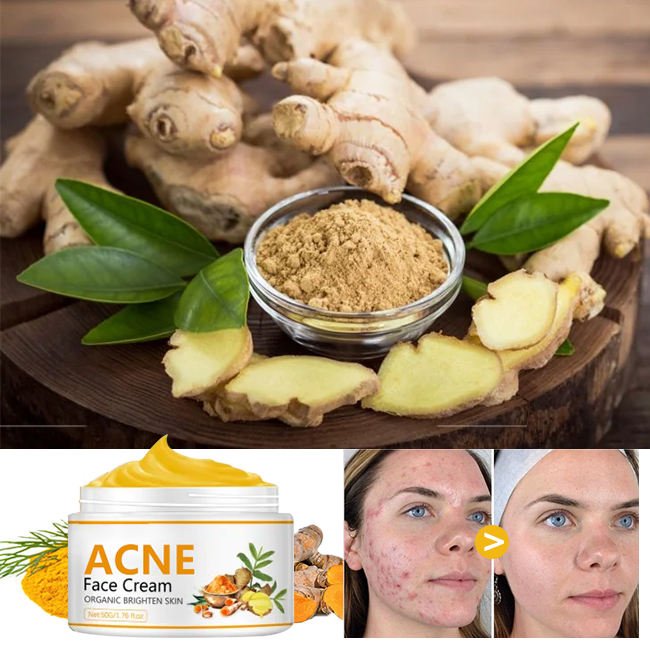 Private Label Skin Care Hyaluronic Acid anti Acne Cream Whitening Facial Creams Brightening Turmeric Face Cream For Women