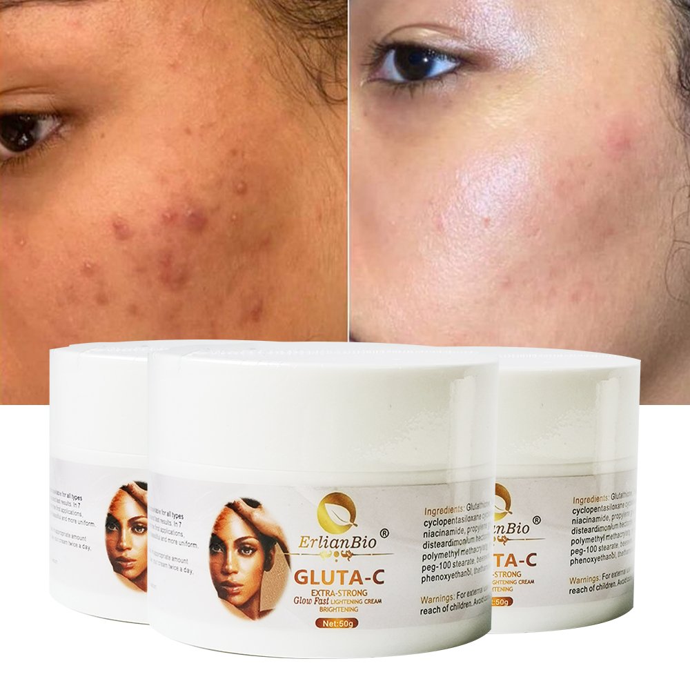 OEM Natural Ingredients Pimples Melasma Blemish Removal Dark Spot Remover Face Cream Moisturizing Whitening Face Cream