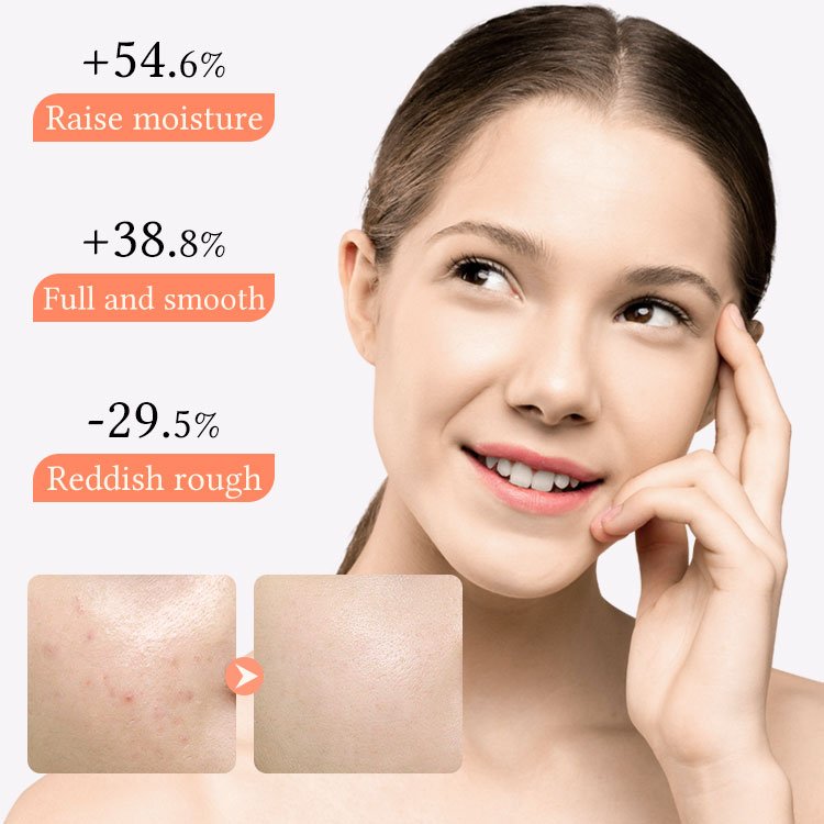 Private Label Turmeric Repairing Face Cream brightening Moisturizing And Hydrating Face Cream Reduce Acne And Dark Spots
