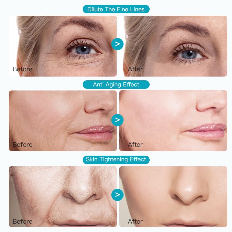 Private Label Firming Lifting Pro xxylane Cream Regenerating Moisturizer Lotion Renewing Face&Neck Lotion FATAZEN Bosein Cream