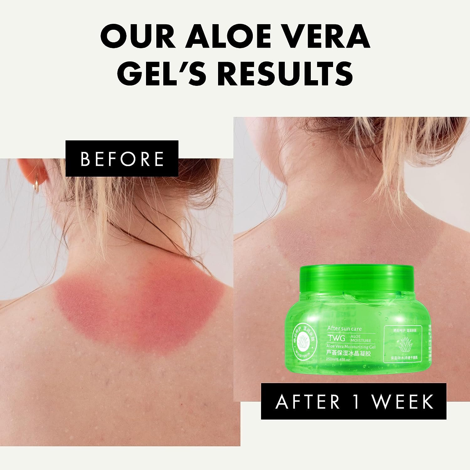 TWG RTS After Sun Redness Smoothing Aloe Vera Gel Face Care Moisturizing Face Cream Natural Organic 99% Pure Aloe Vera Gel