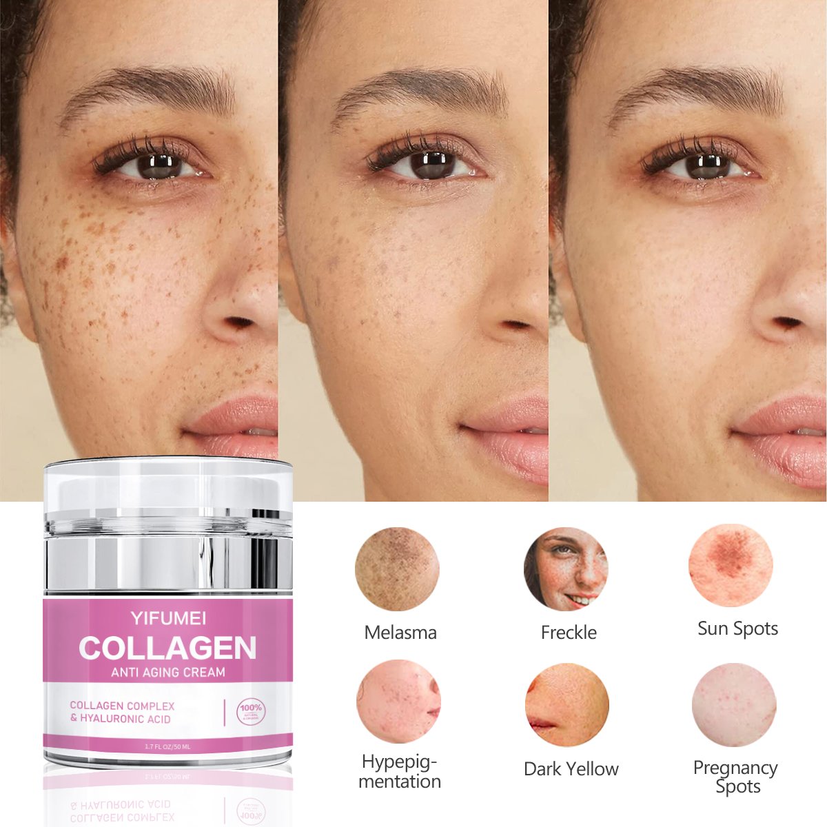High Quality Anti Aging Dark Spot Whitening Collagen Retinol Freckle Removal Face Cream