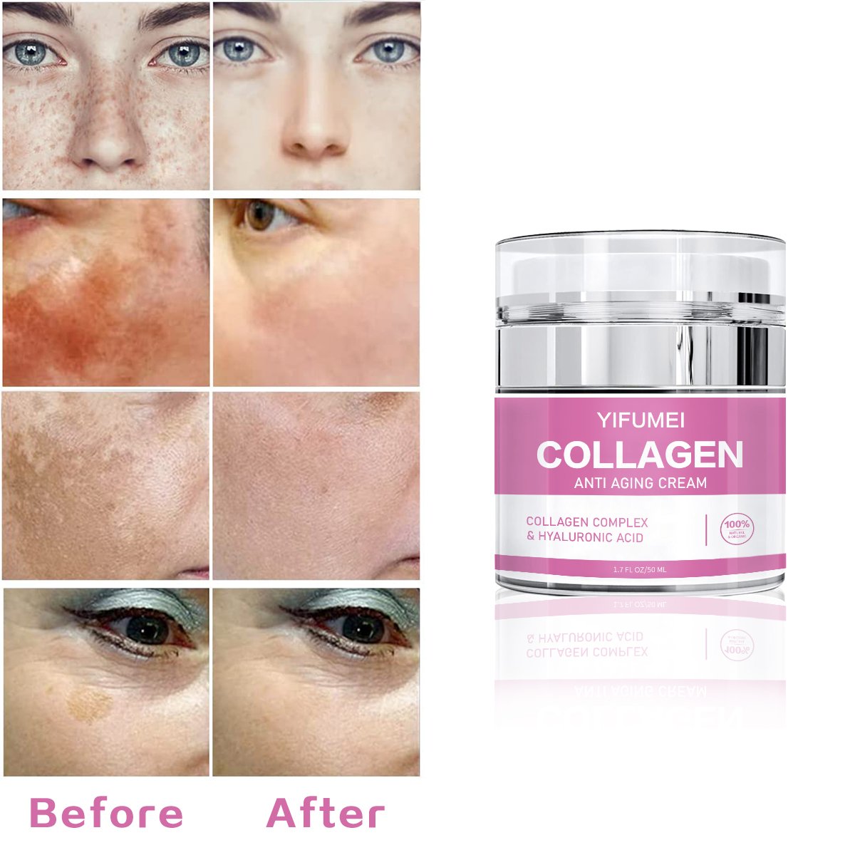 High Quality Anti Aging Dark Spot Whitening Collagen Retinol Freckle Removal Face Cream