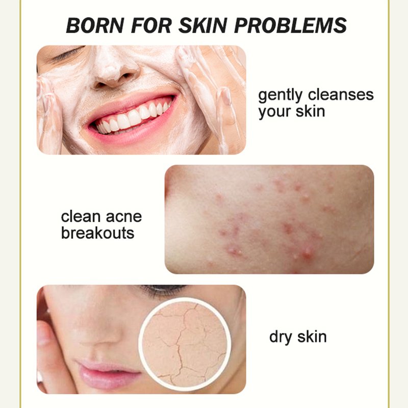 Private Label Facial Cleanser Paraben-free Acne Treatment & Whitening and Organic Vegan & Turmeric Facial Deep Cleanser