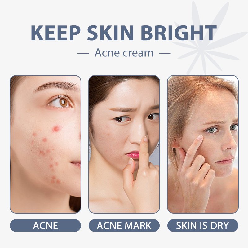 Best Face Cream for Skin Paraben-free Anti-Acne & Repair and Centella & Ceramide Moisturizing Face Cream With My Logo