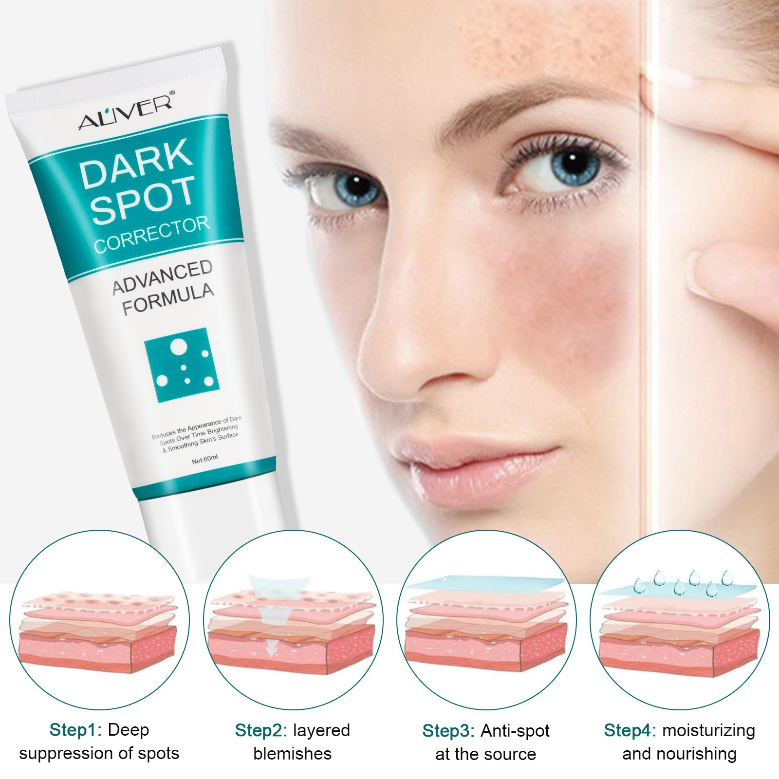 ALIVER Facial Care Freckle Melasma Removal Corrector Whitening Dark Spot Remover Face Cream