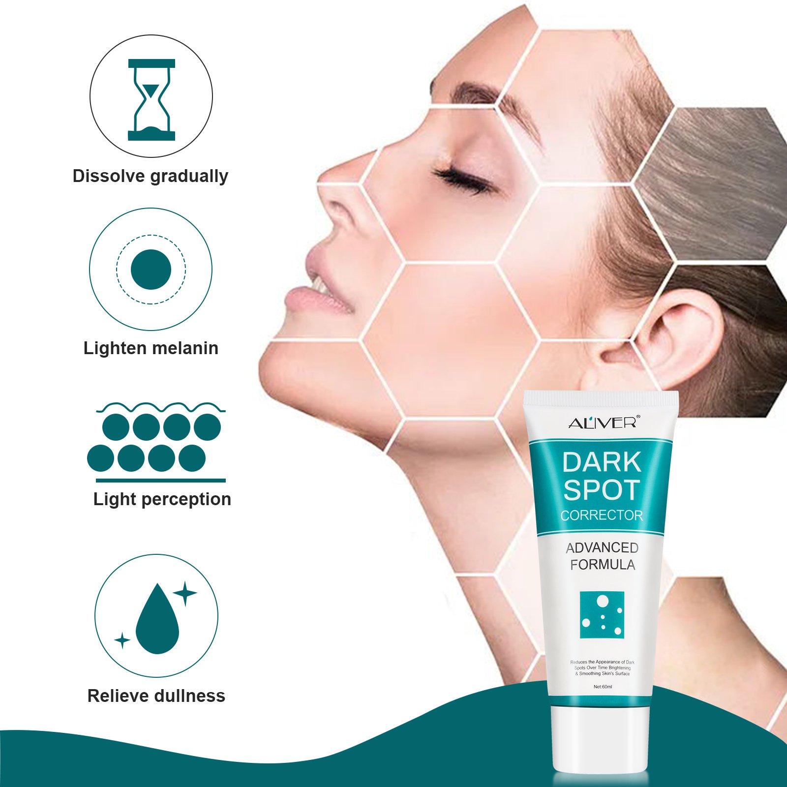 ALIVER Facial Care Freckle Melasma Removal Corrector Whitening Dark Spot Remover Face Cream